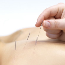 Técnicas de acupuntura en Jáen